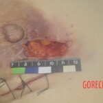 Chinese woman in morgue