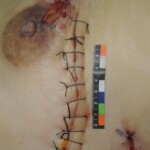 Chinese woman in morgue