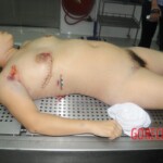 Chinese woman in morgue