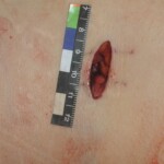 Chinese woman in morgue