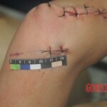 Chinese woman in morgue