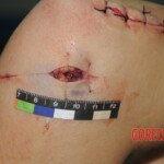 Chinese woman in morgue