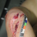 Chinese woman in morgue