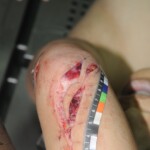 Chinese woman in morgue