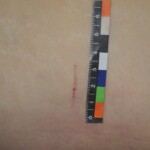 Chinese woman in morgue