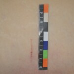 Chinese woman in morgue