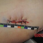 Chinese woman in morgue