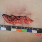 Chinese woman in morgue