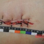 Chinese woman in morgue