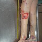 Dead woman in morgue