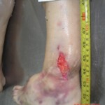 Dead woman in morgue