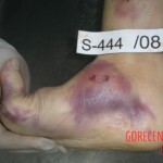 Dead woman in morgue