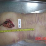 Dead woman in morgue