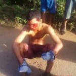 Guy gets his tongue and fingers cut off