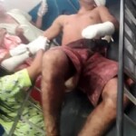 Guy gets his tongue and fingers cut off