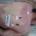 Dead woman in russian morgue