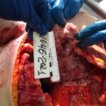 Dead woman in russian morgue