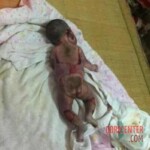 Toddler roasted to death alive