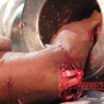 Hand in meat grinder