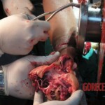Hand in meat grinder