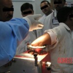 Hand in meat grinder