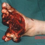 Traffic accident victim