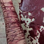 Multiple cuts on arm
