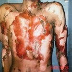 Post-mortem photos of Darren Rainey