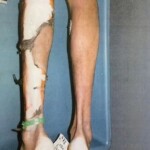 Post-mortem photos of Darren Rainey