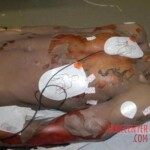 Post-mortem photos of Darren Rainey