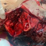 Woman brutally slashed to death