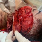 Woman brutally slashed to death