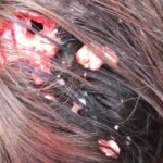 Young woman hit by train