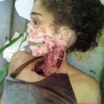 Body of 16-year-old girl found bitten by scavengers