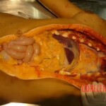 Autopsy of latina girl