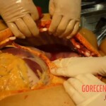 Autopsy of latina girl