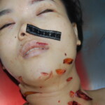 Autopsy of stabbed Chinese woman