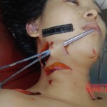 Autopsy of stabbed Chinese woman