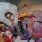 Autopsy of stabbed Chinese woman