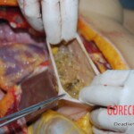 Autopsy of stabbed Chinese woman