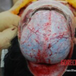 Autopsy of stabbed Chinese woman