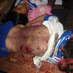 Chinese girls suffered lightning stroke and died