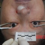 Chinese female in morgue