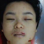 Autopsy of Chinese woman