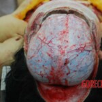 Autopsy of Chinese woman