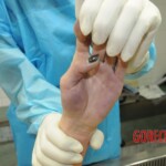 Chinese girl in morgue