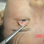 Chinese girl in morgue