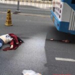 Chinese young girl lost her brain in car accident