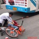 Chinese young girl lost her brain in car accident