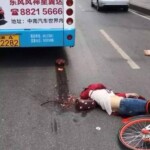 Chinese young girl lost her brain in car accident